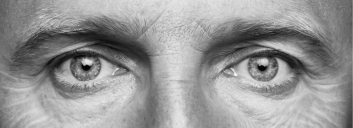 Non è mai solo una ruga!