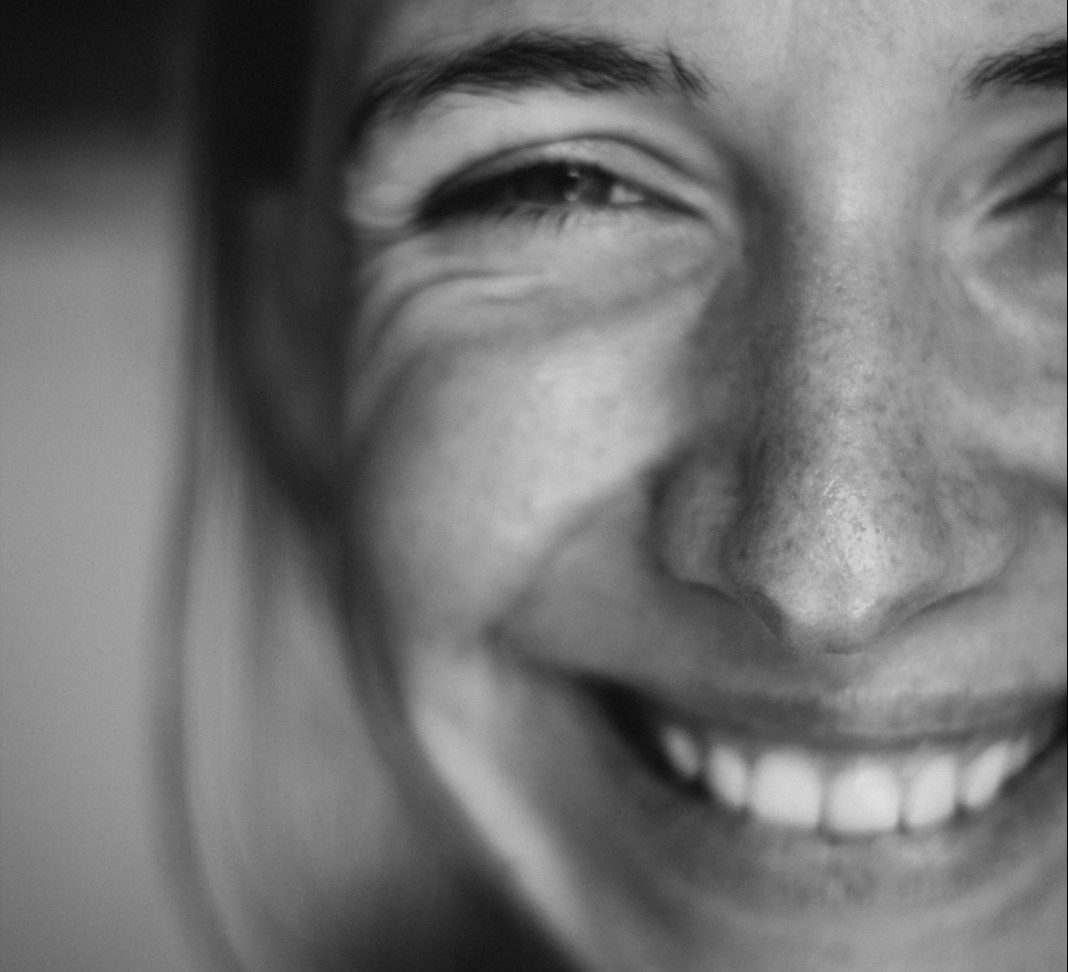 Botulinum toxin (Botox)