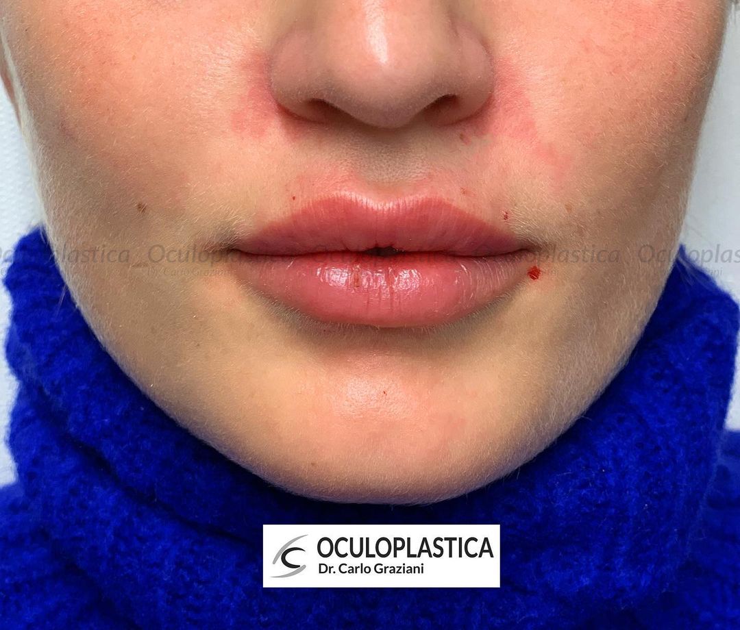 lips