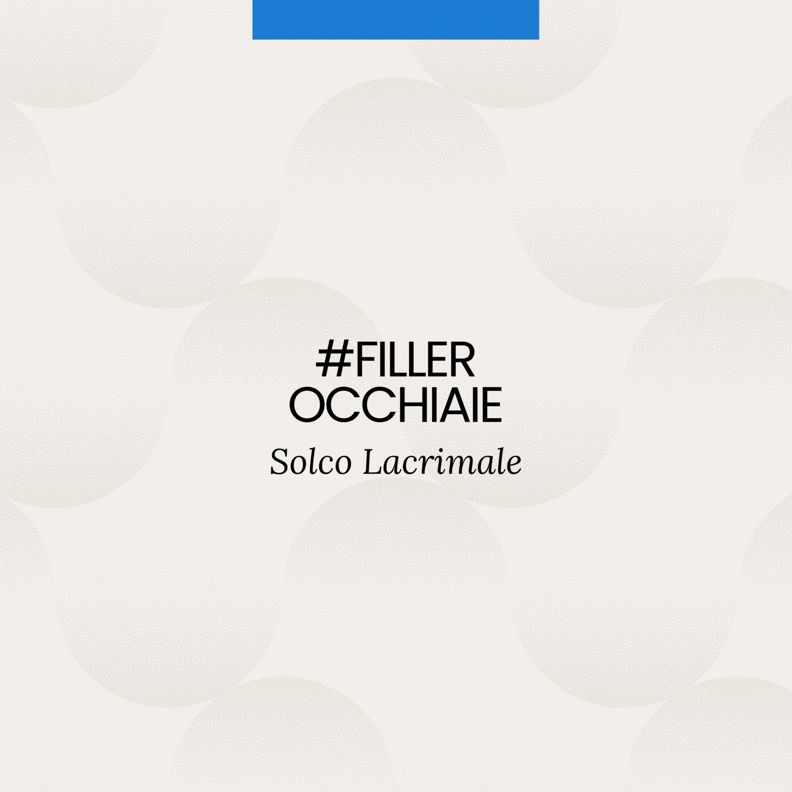Filler occhiaie solco lacrimale