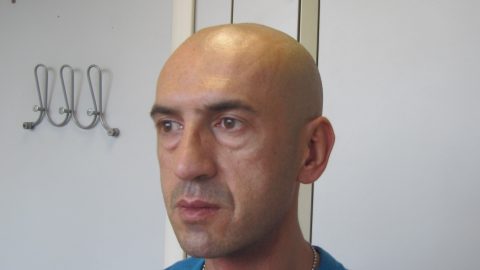 Borse sotto gli occhi