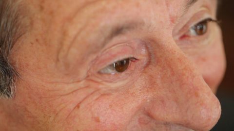 Ricostruzione oculare | Protesi oculari