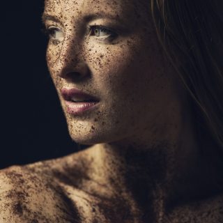 Filler occhiaie: cosa spinge i pazienti a intervenire sul proprio sguardo? Ce lo svela uno studio universitario