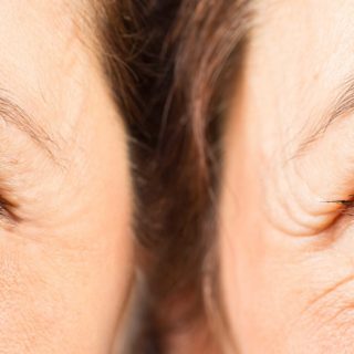 Qual è il miglior periodo dell’anno per sottoporsi a un intervento agli occhi