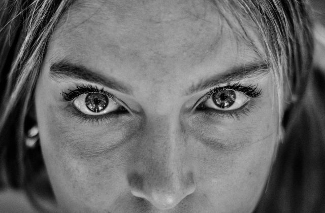 Eliminare occhiaie e cerchi scuri senza chirurgia