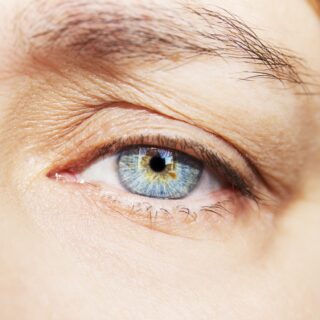 Palpebre raggrinzite, come porre rimedio