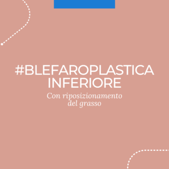 Blefaroplastica-inferiore-con-riposizionamento-del-grasso
