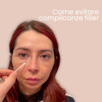 Edema Post complicanze da filler acido ialuronico ialuronidasi