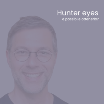 hunter eyes