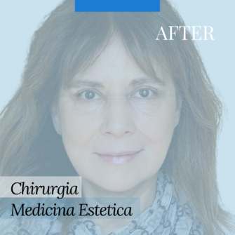 Dopo blefaroplastica ptosi palpebrale