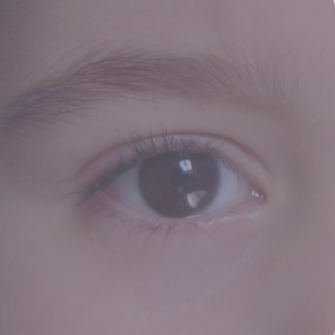 Ptosi palpebrale pediatrica