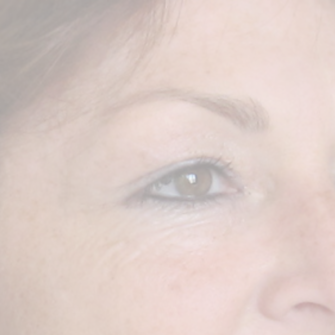 borse sotto gli occhi