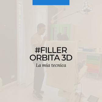 filler orbita 3d acido ialuronico occhiaie