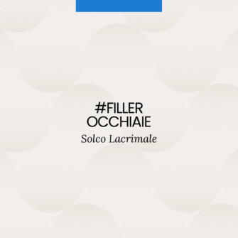 Filler occhiaie solco lacrimale Filler occhiaie solco lacrimale
