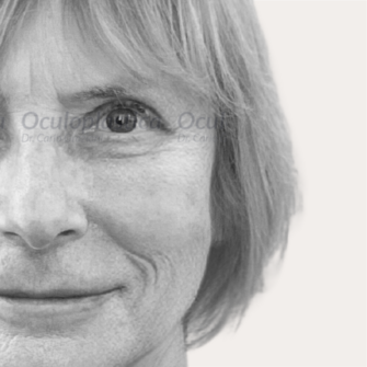 Dopo Blefaroplastica superiore 2.0 EyeDefine Lyft