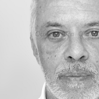 Lifting Sopracciglio EyeDefine Lyft Lipofilling Lifting Sopracciglio EyeDefine Lyft Lipofilling