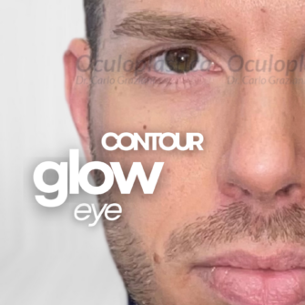 EyeGlow Contour Hunter Eyes palpebra superiore asimmetria